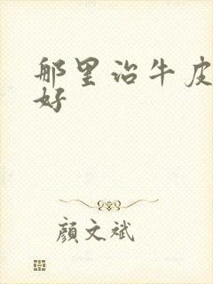 那里治牛皮血癣好