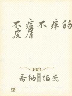不痛不痒的癣有皮屑