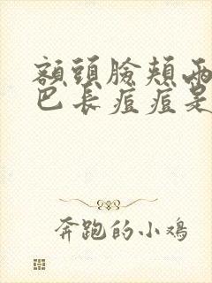 额头脸颊两侧下巴长痘痘是什么原因封面
