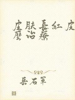 皮肤长红皮癣怎么治疗