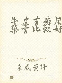 牛皮有癣用什么药膏比较好