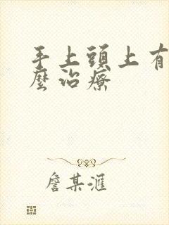 手上头上有癣怎么治疗封面