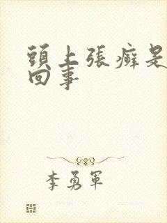头上张癣是怎么回事