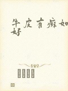 牛皮有癣如何治好