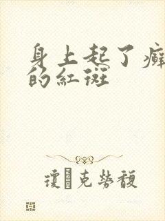 身上起了癣一样的红斑