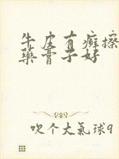 牛皮有癣擦什么药膏子好