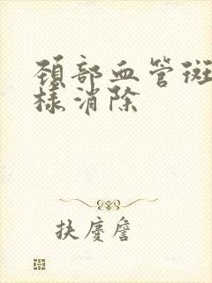 颈部血管斑块怎样消除