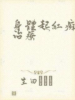 身体起红癣怎么治疗