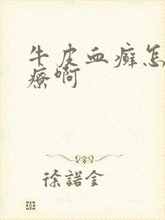 牛皮血癣怎么治疗啊