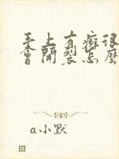 手上有癣很痒还会开裂怎么治