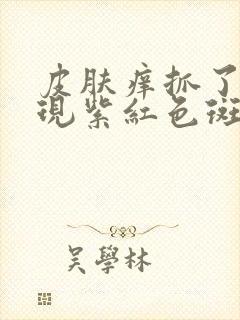 皮肤痒抓了后出现紫红色斑点