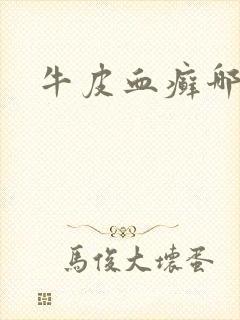 牛皮血癣哪里治