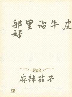 那里治牛皮血癣好
