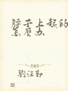 脖子上起的像癣怎么办