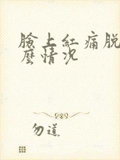 脸上红痛脱皮什么情况封面