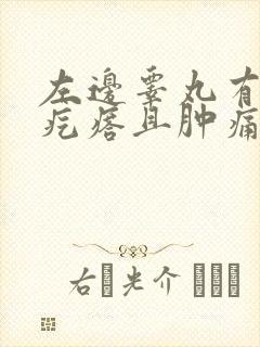 左边睾丸有个硬疙瘩且肿痛