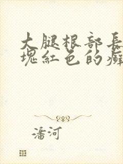 大腿根部长了一块红色的癣