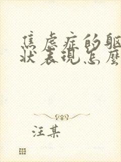 焦虑症的躯体症状表现怎么样缓解