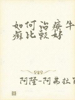 如何治疗牛皮有癣比较好