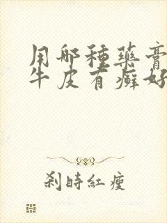 用哪种药膏治疗牛皮有癣好