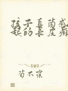 孩子真菌感染引起的长皮癣怎么办
