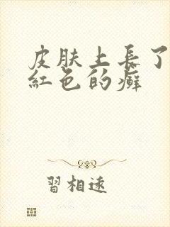 皮肤上长了一块红色的癣