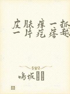皮肤痒一抓就起一片疙瘩越挠越痒封面