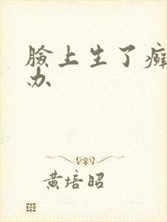 脸上生了癣怎么办