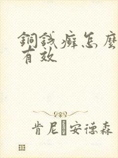 铜钱癣怎么治疗有效封面