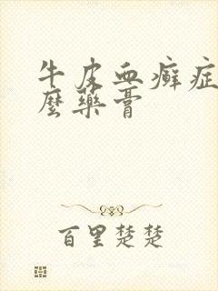 牛皮血癣症涂什么药膏