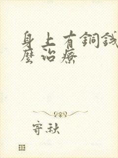 身上有铜钱癣怎么治疗