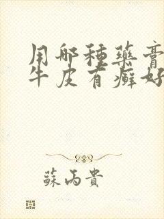 用哪种药膏治疗牛皮有癣好