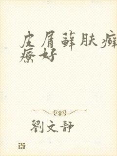 皮屑藓肤癣哪治疗好