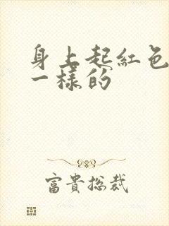 身上起红色像癣一样的