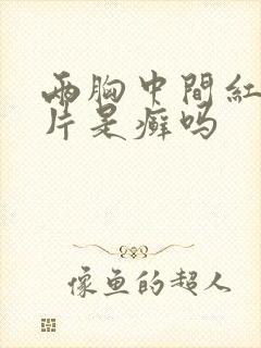 两胸中间红了一片是癣吗