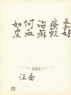 如何治疗季节牛皮血癣较好