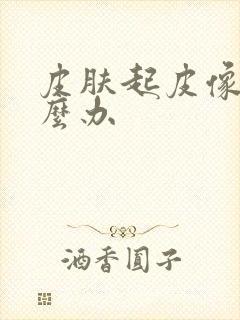 皮肤起皮像癣怎么办封面