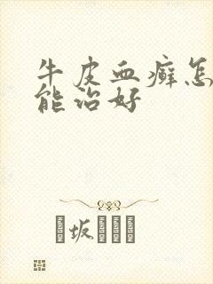牛皮血癣怎样才能治好