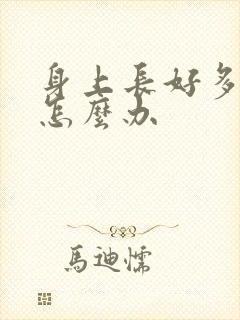 身上长好多圆癣怎么办