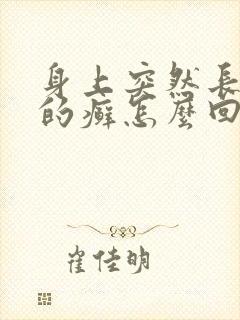 身上突然长红色的癣怎么回事