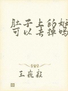 肚子上的妊娠纹可以去掉吗