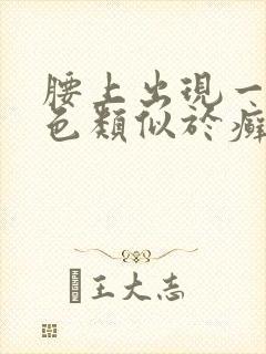 腰上出现一块红色类似于癣