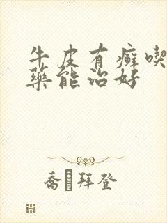 牛皮有癣吃什么药能治好