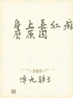 身上长红癣是什么原因