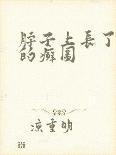 脖子上长了红色的癣图