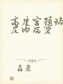 高度宫颈鳞状上皮内病变封面
