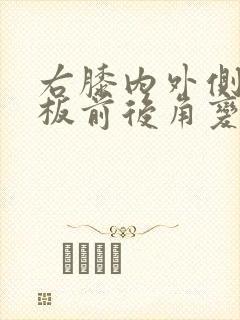 右膝内外侧半月板前后角变性