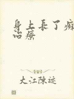 身上长了癣怎么治疗