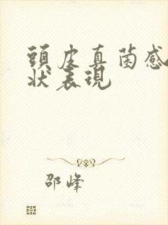 头皮真菌感染症状表现