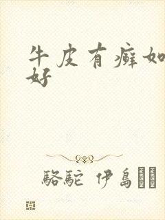 牛皮有癣如何治好